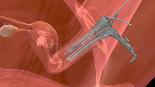 子宫内膜 转移 体外受精 人类 实验室 子宫颈 子宫 女性素
