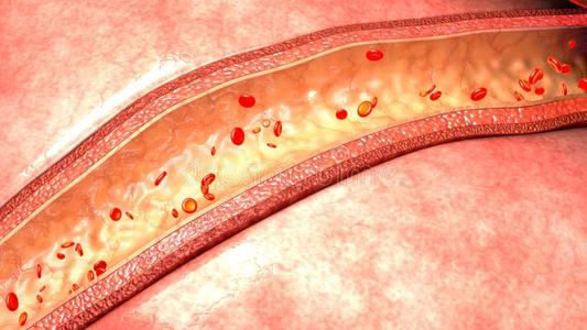 血管中的血流照片