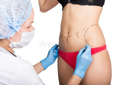 女性医生在女性身体上做虚线进行脂肪校正。 整容手术。 抬起和乳房