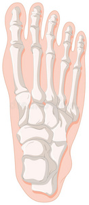痛风脚趾骨X线