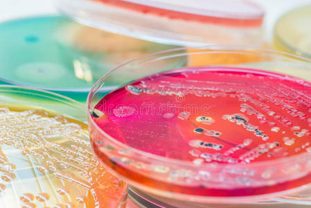 细菌培养在选择性琼脂培养基(ss琼脂)上培养细菌菌落)照片