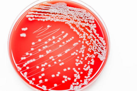 血琼脂培养基上的细菌培养生长金黄色葡萄球菌。