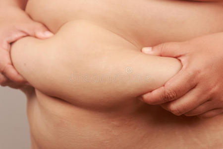 医疗保健 损失 男人 重量 人类 成人 身体 饮食 腹部