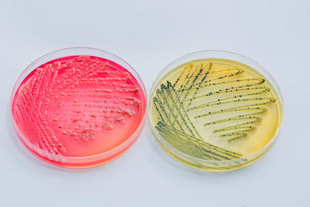 在鉴别和选择性培养基上培养细菌菌落照片