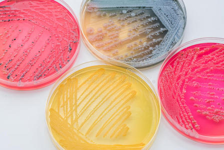 我姓辛在选择性琼脂培养基xlt琼脂(xy)上培养细菌菌落照片