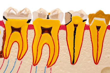 牙科模型，牙齿模型