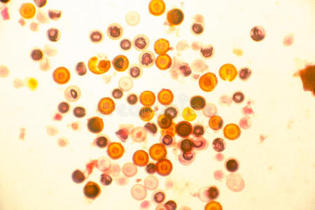 猪带绦虫的卵照片