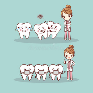 可爱的卡通牙套照片