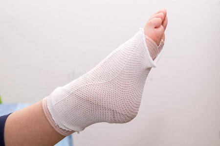 里年轻女子穿着浴袍在床上使用电脑脚踝和脚疼痛或受伤医生包扎脚踝