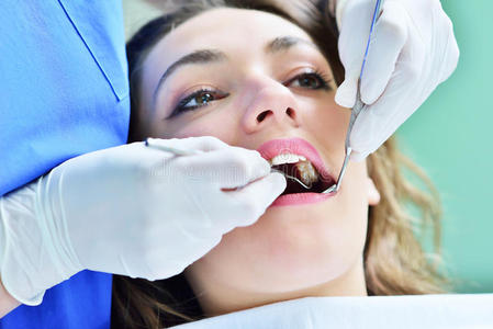 在牙医的口腔检查中,女性张口的特写镜头.照片