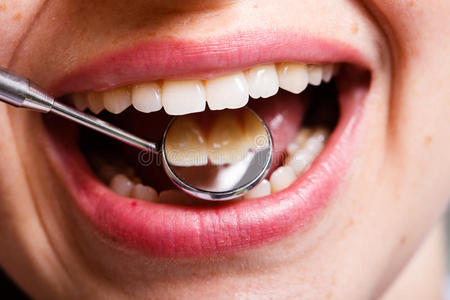 牙科牙科口腔和牙齿微笑