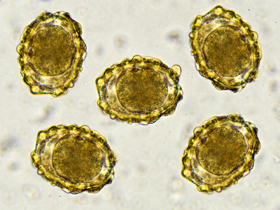 蛔虫卵图片
