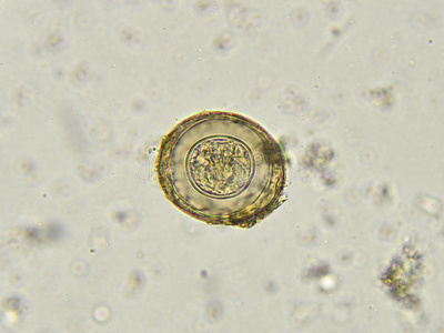 显微镜下虫卵图片图片