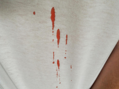 织物上的血迹照片
