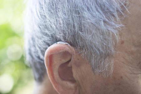医学 古老的 帮助 听力学 音频 听力 头发 照顾 耳聋