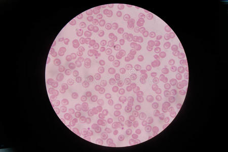 细胞 计数 齐卡 血液学 弄脏 测试 实验室 贫血 凝块