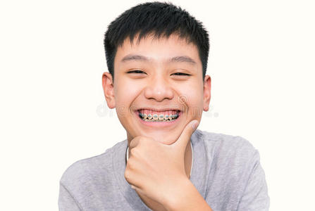 美丽的微笑，英俊的男孩，牙齿支撑牙齿。
