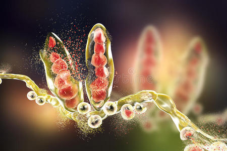 糠秕孢子菌图片