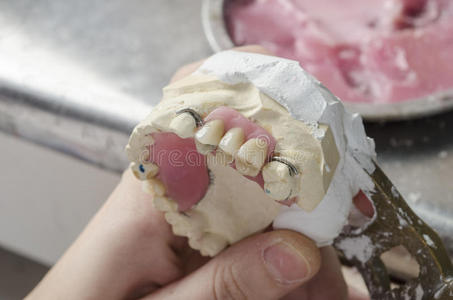 牙科技师做丙烯酸树脂的部分假牙。