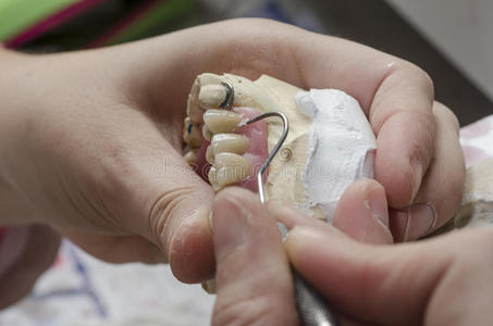 牙科技师做丙烯酸树脂的部分假牙。
