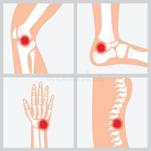 关节和骨骼的疾病。