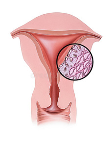感染 人类 解剖 输卵管 子宫内膜异位症 月经 公司 卵巢