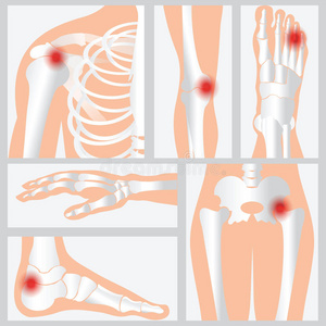 关节和骨骼的疾病。