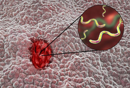 流明 吸收 内衬 细胞 上皮细胞 十二指肠 组织 人类 酸的