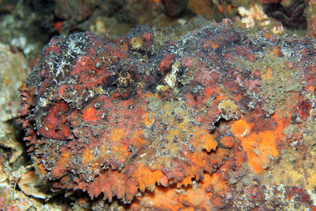 脚底疣的图片图片