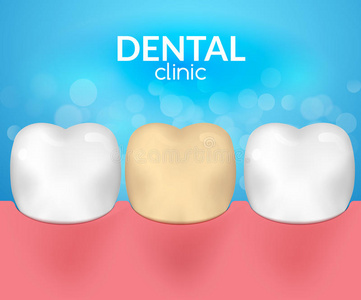 牙科疾病临床概念。 牙齿保健卫生。 牙痛需要牙医