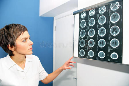 内颅CT计算机断层扫描，头部ct