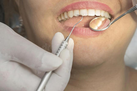 健康的女性牙齿和牙医的口腔镜照片