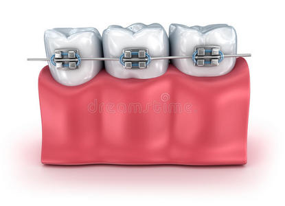 健康 保护 医学 咧嘴笑 义齿 照顾 医生 疼痛 插图 卫生