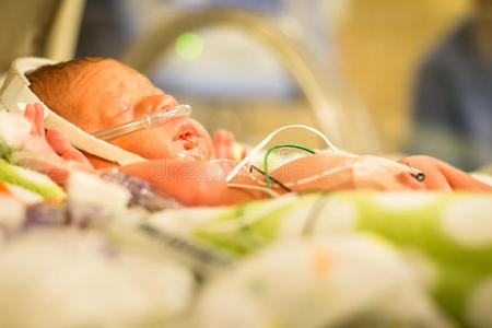 早产儿 过早 尼库 孵化器 奶嘴 医院 紫色 女孩 睡觉