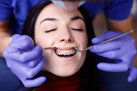 牙医检查女人牙套