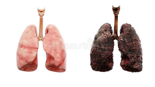 尼古丁 细胞 医学 疼痛 癌症 病人 香烟 胸部 器官 呼吸