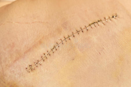 红色的伤口图片-红色的伤口素材-红色的伤口插画-摄图新视界