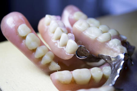 塑料 假肢 义齿 牙科 降低 特写镜头 假牙 医学 人类