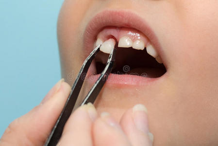 拔牙的小孩图片-拔牙的小孩素材-拔牙的小孩插画-摄图新视界