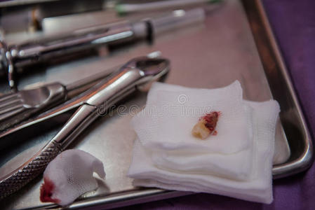 提取 卫生 牙医 牙科 医院 办公室 疼痛 失去 医生 程序