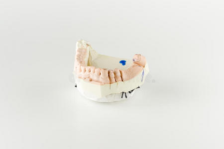 人工牙的石膏模型
