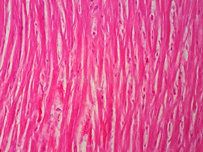 生物学 健康 形象 主动脉 医疗保健 中庭 身体 动脉 冠状动脉