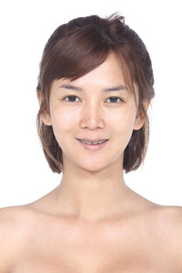 化妆前的亚洲女人。 没有润肤，新鲜的脸上有痤疮，SK