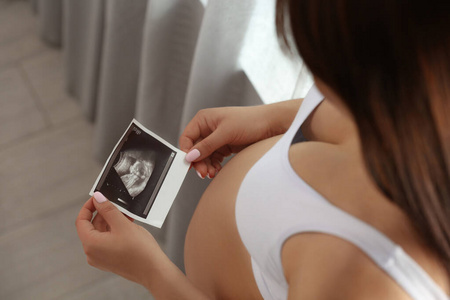 孕妇家里有超声波照片，特写