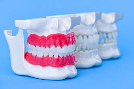 人类有牙齿和牙龈的下颚解剖学模型