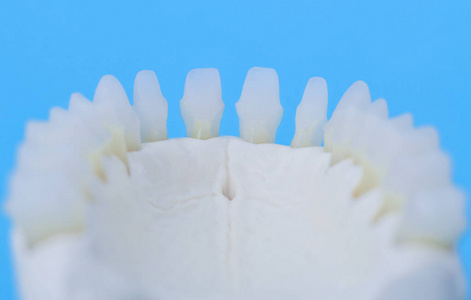 下颌骨含牙解剖模型