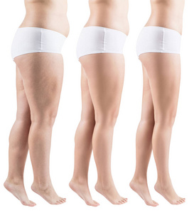 女性瘦身前后腿部侧视图。