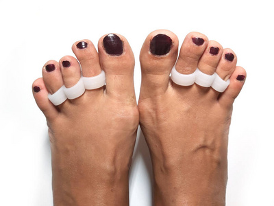 脚趾矫正器硅胶外翻大拇趾束夹板伸直脚.骨科硅胶支架.照片