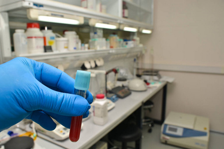 Laboratory examination of a blood sample. 