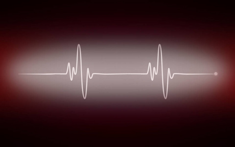 心电图监护仪上的心脏脉搏图图片